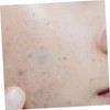 FOMIYES 6-pack Pimple Patches Invisibly Treat Blemishes Breathable Comfortable Stickers