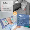 Mybow Neck Stabilizer Head Support Pillow, Post Surgery Pillow for
