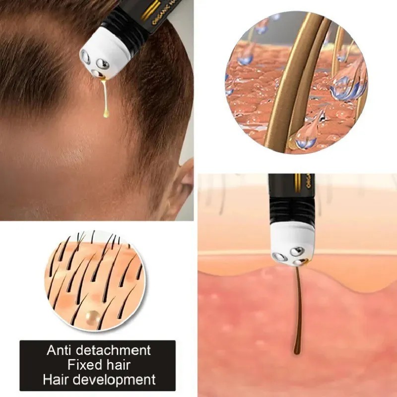 Rollo De Suero Orgánico Para El Crecimiento Del Cabello Recr