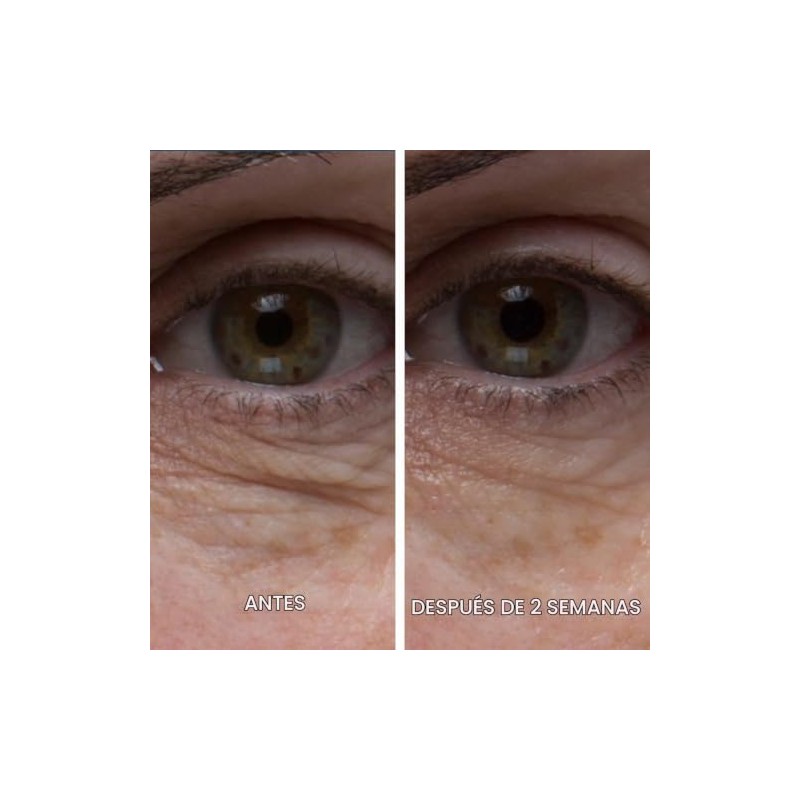 ELEMIS Peptide⁴ Eye Recovery Cream, Reviving Eye Cream, 0.5 fl.