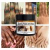 */crema Iluminadora De Nudillos Oscura Para Manos, Codos Y R
