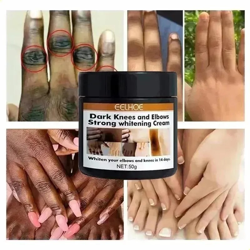 */crema Iluminadora De Nudillos Oscura Para Manos, Codos Y R