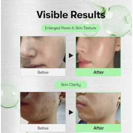 Vt Shot 100b Snail Reedle Serum Facial Reparador Coreano Todo Tipo De Piel Danoche                                                                    