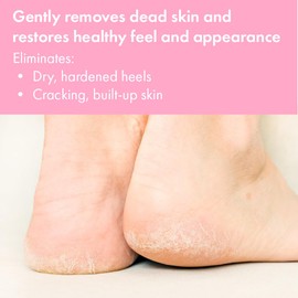 VITÉ20 Heels Foot Cream