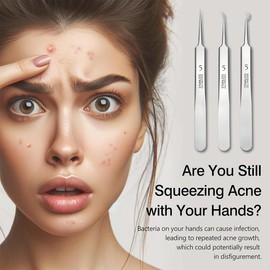 Set of 4 pimple tweezers, blackhead remover, comedone squeezer, stainless steel blackhead remover set, with metal housing, for removal of blackheads on nose and face, unisex