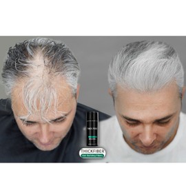 THICK FIBER Hair Building Fibres (1 Piece, White) Hair Fibres for Thinning Hair, Hair Powder for Thin Hair, 25g Bottle, Leave the