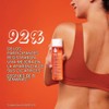 Bio-Oil® 6.7oz: Multiuse Skincare Oil