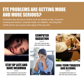 Retinol Eye Cream Stick Lightens Eye Bags Dark Circles Eye Lines Hydrates, Moisturizes & Firms Skin Around Eyes