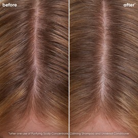 Biolage Biolage Scalp Sync Calming Shampoo | Calms & Hydrates Dry or Irritated Scalp | Paraben & Silicone Free | For Sensitivity Control | Vegan & Cruelty Free | Salon Shampoo