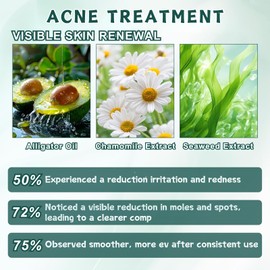 Instant Mole & Spot Remover Gel, Professional Spot Corrector Gel - Mole, Dark S-pot Remover for Face &Body with Natural Extracts, Reduces Dullness and Blemishes, Non-Comedogenic Moisturiser