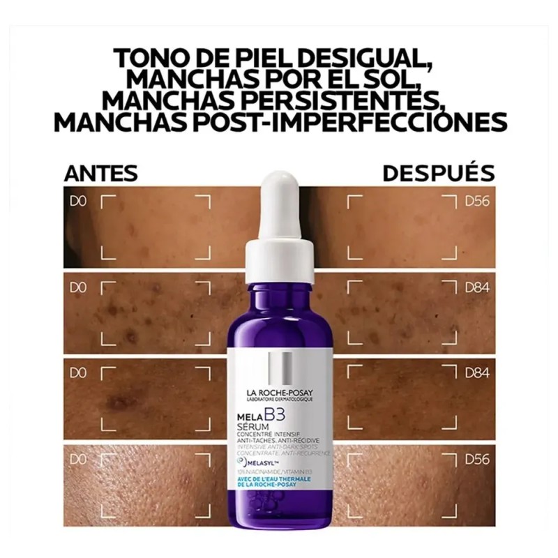 Sérum concentrado Mela B3 La Roche-Posay antimanchas 30mL L'Oréal