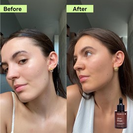 Endless Luxe - Glow Drops - Serum Autobronceador Facial - Serum Enriquecido con Ácido Hialurónico Y Vitamina C - Todo Tipo de Piel - Hidratante, Libre De Parabenos Y Vegano - 27 ml - GDR23