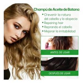 Champú De Batana Con Aceite De Romero Para Reducir La Caída                                                                                           
