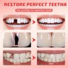 2pcs Missing Tooth Replacement Kit, Denture Repair Kit, Dental Impression