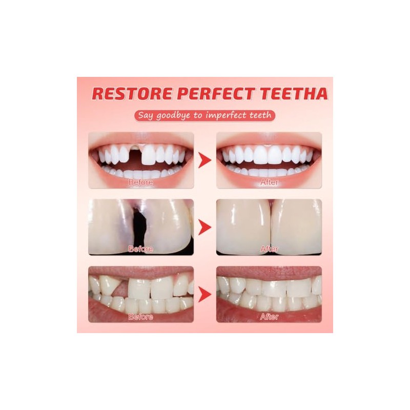 2pcs Missing Tooth Replacement Kit, Denture Repair Kit, Dental Impression