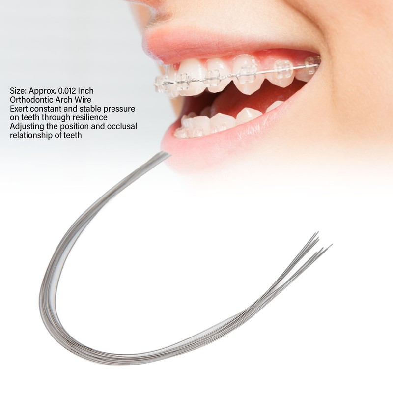 100pcs Orthodontic Arch Wire Stainless Steel Elastic Dental Orthodontic Round