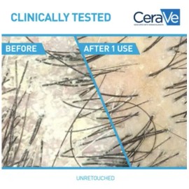 Cerave Hydrating Anti-dandruff Shampoo, All Hair Types, 12oz                                                                                          