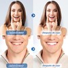 15Pares-30 Tiras Tiras Blanqueadoras De Dientes, Limpia los Dientes Efectivamente