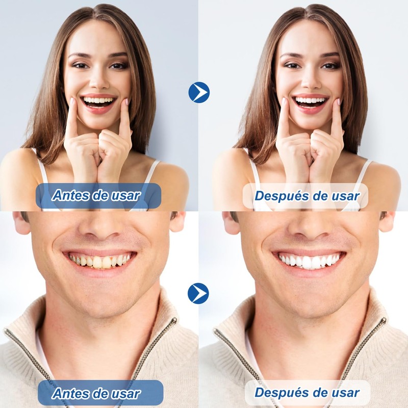 15Pares-30 Tiras Tiras Blanqueadoras De Dientes, Limpia los Dientes Efectivamente
