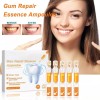 generic 14 Piezas De Gel Dental Para Restauración
