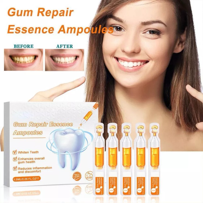 generic 14 Piezas De Gel Dental Para Restauración