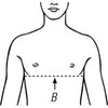 Bort 102900 Women's Rib Support Belt, Rib Injury Binder Belt,