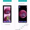 ScopeAround Ear Endoscope Otoscope Dual View Ear Wax Cleaning Camera