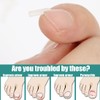 60 Pieces Painless Toenail Smoothing Strips with Nail Remover +