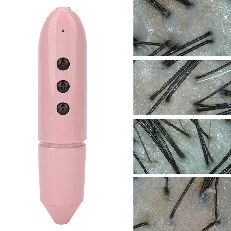 Hair Detector Scalp Skin 2MP Camera 100x WIFI Facial Wireless