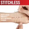 Emergency Wound Closure Strip - Laceration Closure Kit - Stitchless