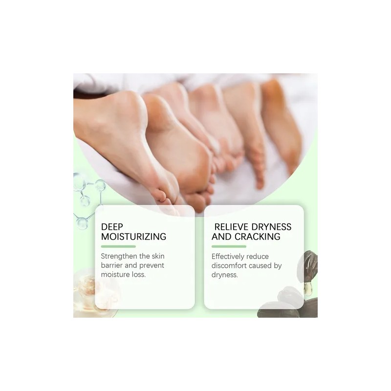 Mzhl Fe Crema De Urea For Manos Y Pies (1