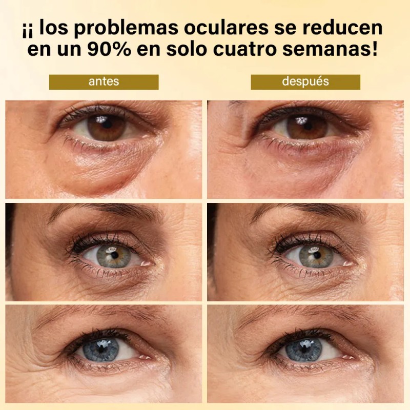 Kit Roll Anti Ojeras Bolsas Mirada Fresca Mopoyat