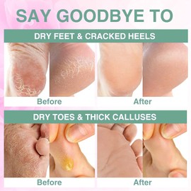 BELA DIVO Foot Peel Mask (2 Pairs) - Exfoliating Peeling Away Calluses and Dead Skin Cells - Remove Cracked Heels, Dead Skin & Calluses - Make Your Feet Baby Soft - For Men & Women (Lavender)