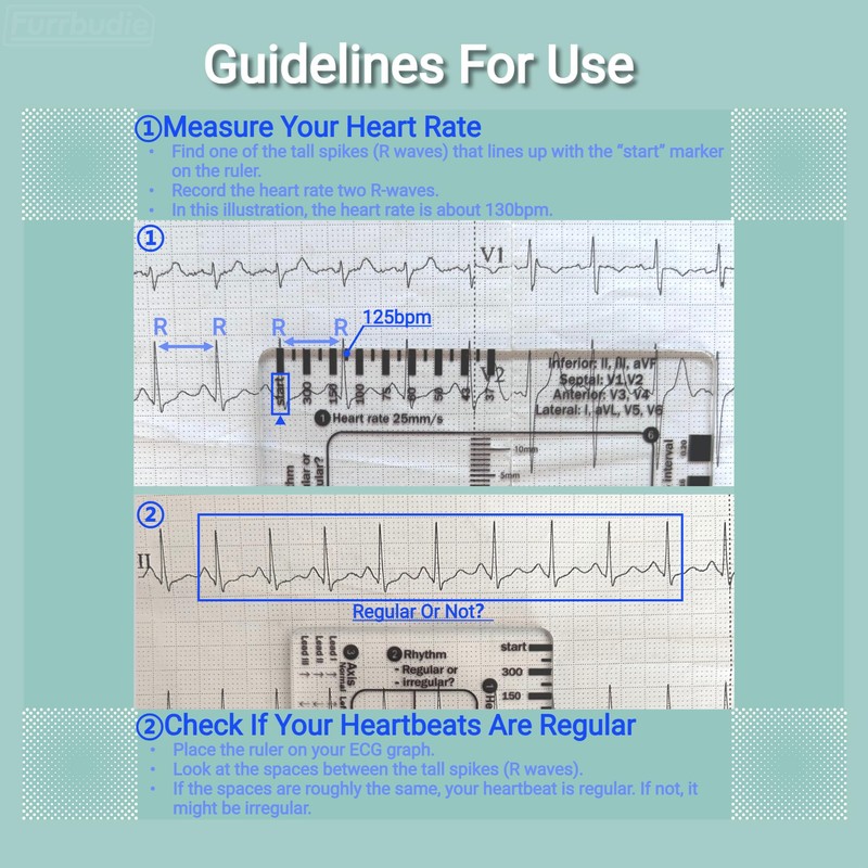 ECG 7 Step Ruler 2pcs ECG Ruler Plastic Ruler Measuring