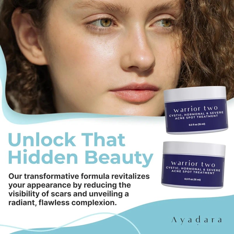 Tratamiento Localizado Para El Acné Quístico, Tratamiento Ho