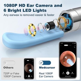 Medcursor Ear Wax Removal, Ear Wax Removal Tool Camera with 1080P HD Smart Visual Otoscope, Ear Cleaner with 6 LED Lights and 6 Soft Ear Scoops