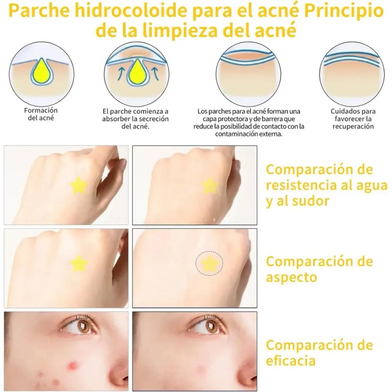 Miniso Tiras Nasales Para Mujer Puntos Negros Rosa 10 Piezas