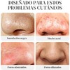 GWMWON Puntos Negros, Mascarilla Puntos Negros 30g