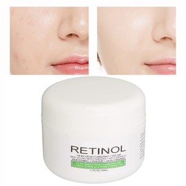 Crema Blanqueadora para Axilas de 50ml, Aclara, Hidrata, Axila, Partes Privadas, Crema para la Piel