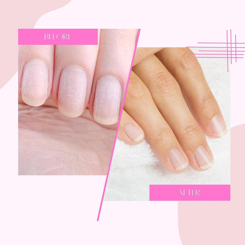 NAILSTORE - Nagelhautöl und Nagelöl, Nagelhautbehandlung Revitalisierendes Nagelöl - Kokosnuss