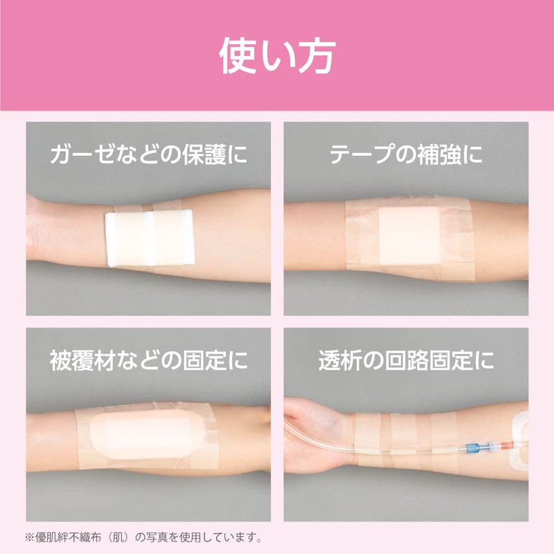 Nitoms Superior Skin Bond GS 1.0 inches (25 mm) x