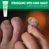 Toenail Softener for Thick Hard Toenails - Safe for Seniors