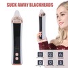 Electric Vacuum Blackhead Remover Rechargeable Face Pore Cleaner Acne Whitehead