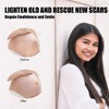 Silicone Scar Sheets 1.6" x 6" Silicone Scar Tape for