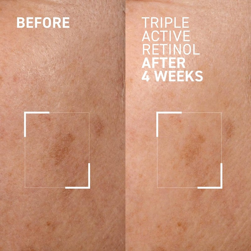 Dr.Brandt BTW Triple Active Retinol Gentle Overnight Renewal Cream for