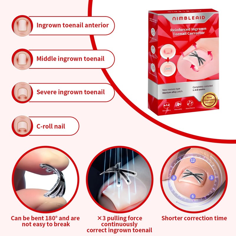 Upgraded Titanium Alloy Ingrown Toenail Corrector with Upgraded 6-Angle Shape,3x