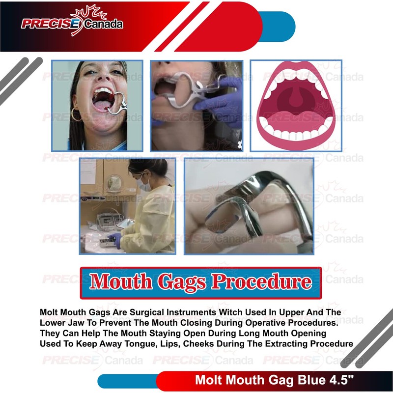PRECISE CANADA Molt Mouth Gag Blue 4.5" Dental Instruments