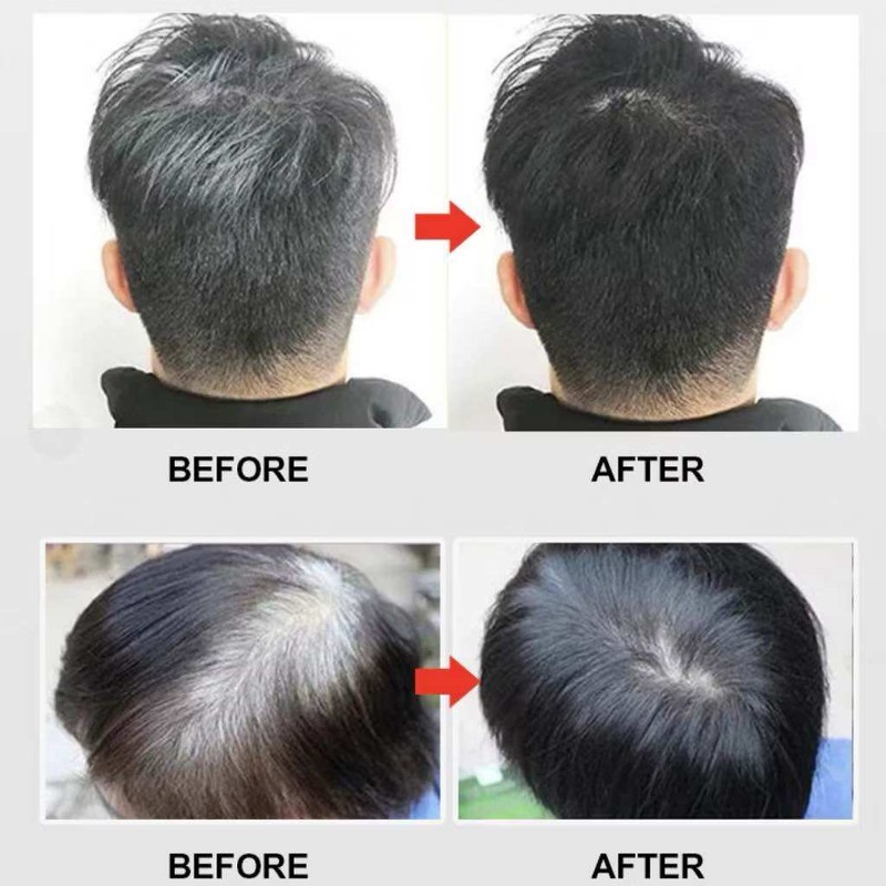 DEXE Black Hair Shampoo 400ML Instant Hair Blackening Hair Dye