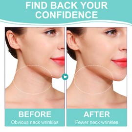 spacemor Neck Tapes, Neck Lifting Stickers Women Skin Care Neck Lift Bands, Instant Face Neck Lifting Stickers (4pcs bands, 20pcs replace tapes)