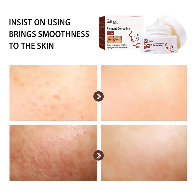 Hidratante Facial Eelhoe Para Hidratación Y Suavidad Diarias